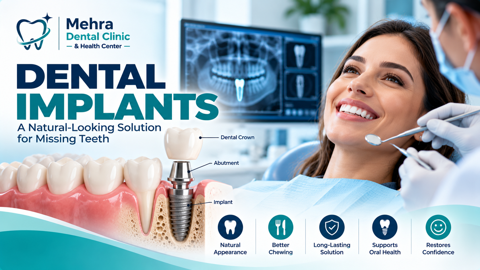 Dental Implants: Benefits, Procedure, Cost & Aftercare